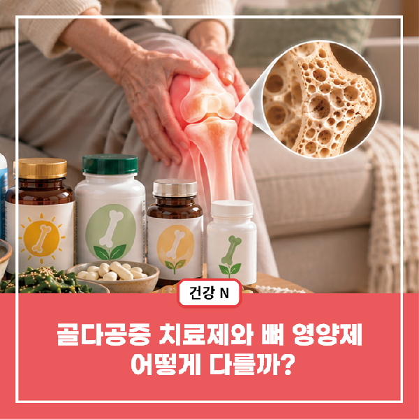 [건강N] 골다공증 치료제와 뼈 영양제, 어떻게 다를까?